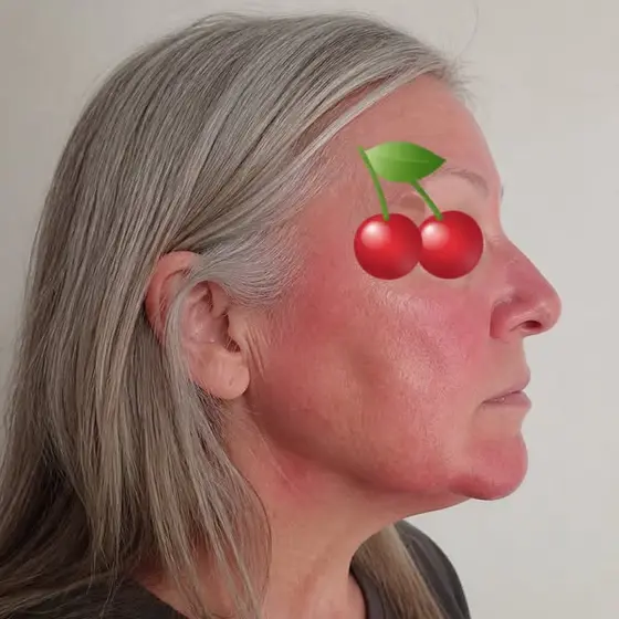 Den verkliga anledningen till att din rosacea alltid kommer tillbaka, och det h…