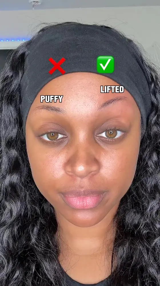 Dieting never touched the heaviness in the face