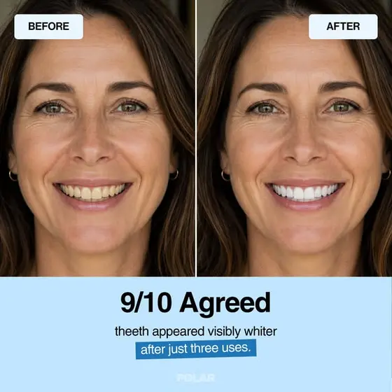 The Solution To A Confident Smile!