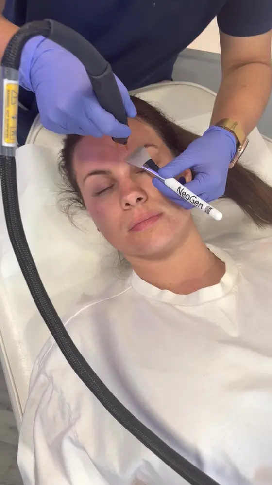 NeoGen Plasma has arrived at Evolve