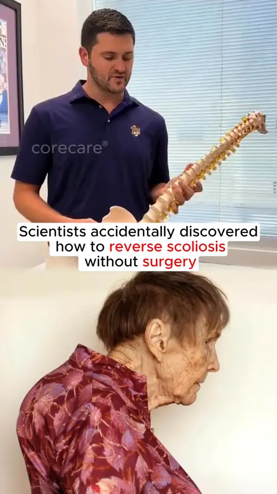 Back, Neck & Shoulder Pain? Fix Your Posture Instantly