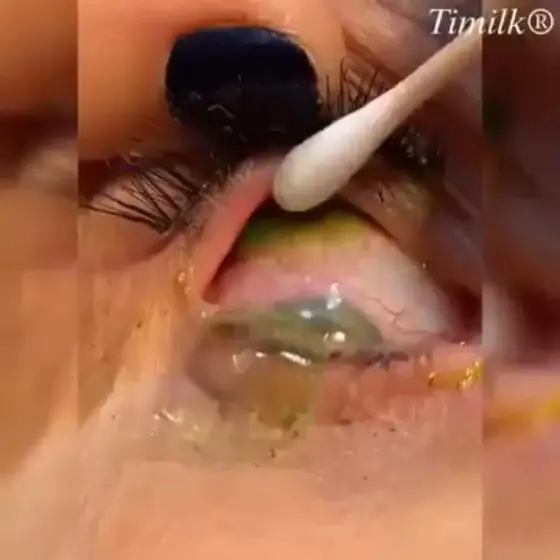 Ne laissez pas le vieillissement de vos yeux vous freiner.
Retrouvez une vision…
