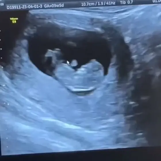 💖⚡Fresh Plot, Instant Obsession!👉👉