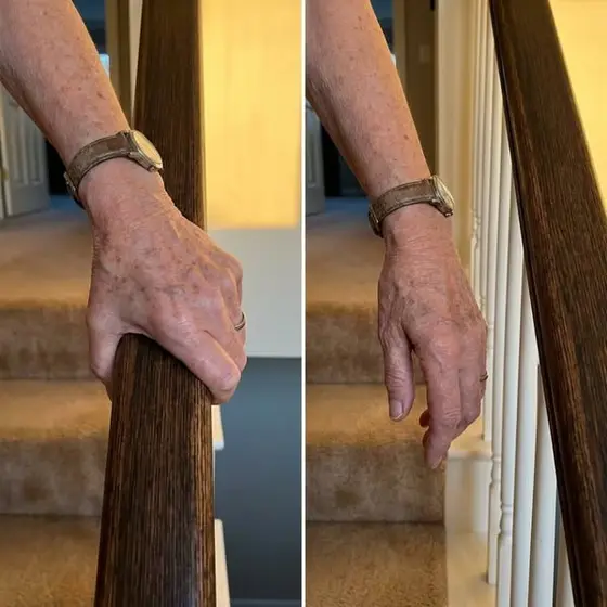 Mein Vater stürzte im März die Treppe hinunter. Was ihm niemand über seine Medi…
