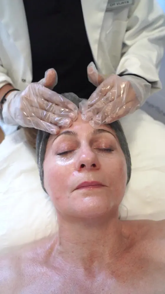 Chemical Peels In Kensington Up To 50% OFF 🧼