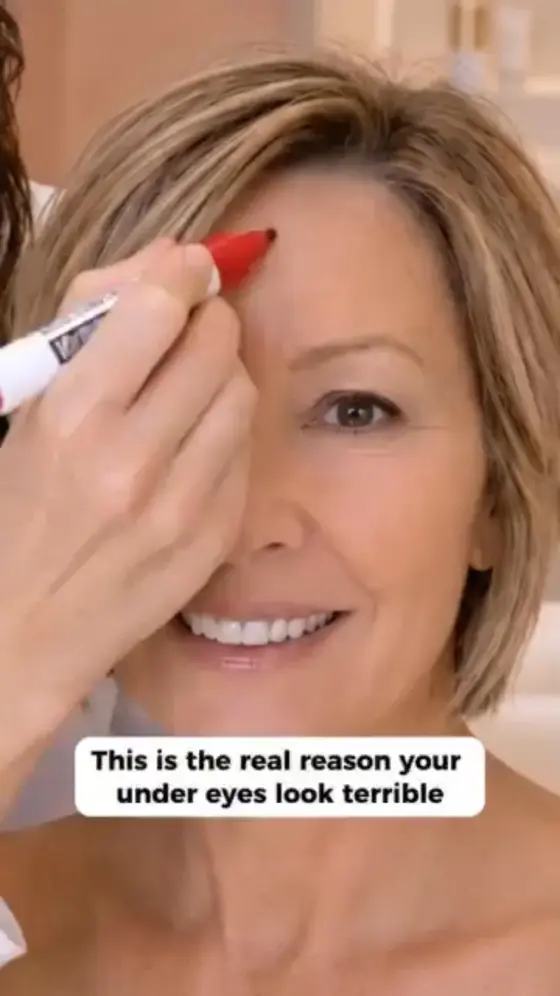 ✨LAST DAY BUY 1 GET 1 FREE✨REVIVE TIRED EYES -HYDRATING & ANTI-WRINKLE EYE BALM
