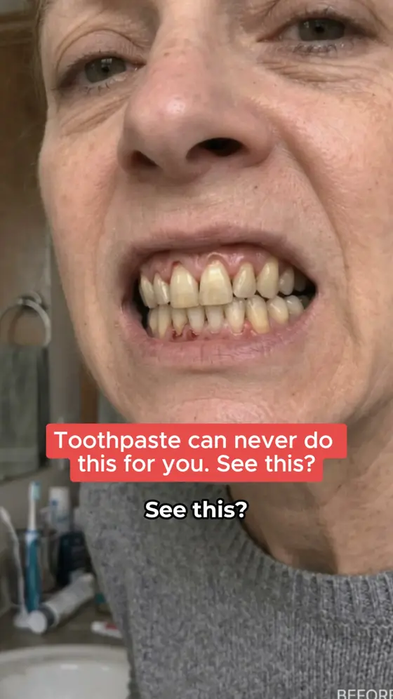 Fix gums from the inside out →