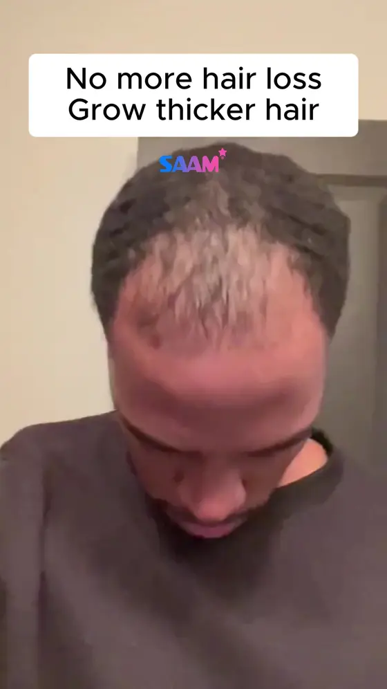 🔬 Reactivate Your Hair