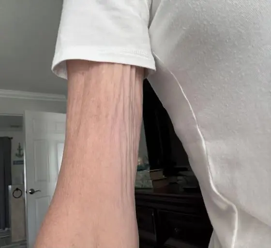 How I got rid of my saggy arms 👆