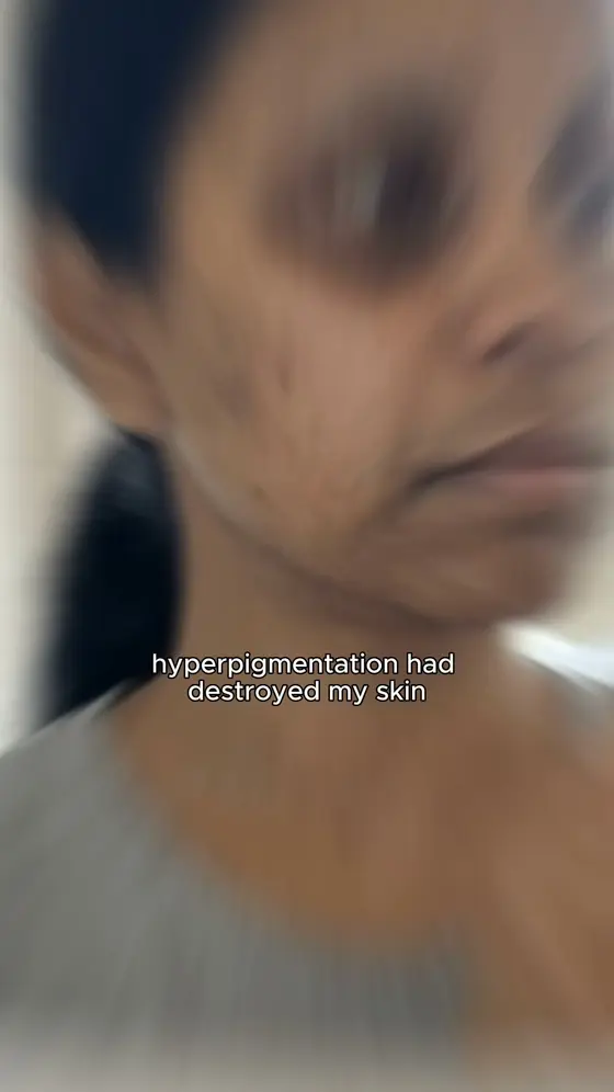 Why Kaavi finally works on South Asian skin →