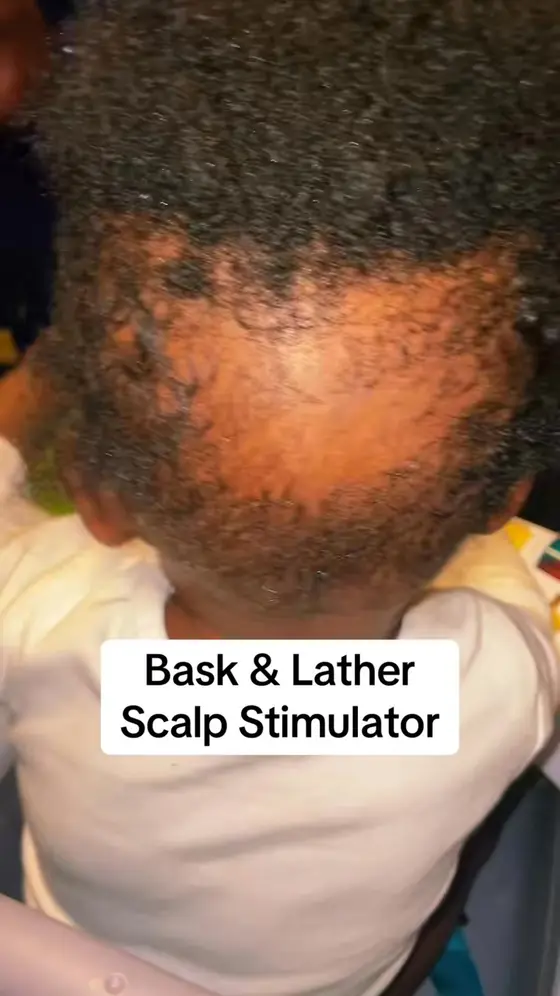 🔥Scalp Stimulator