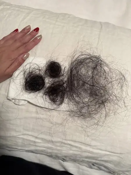 The No BS Solution For Thinning Hair In 50s
