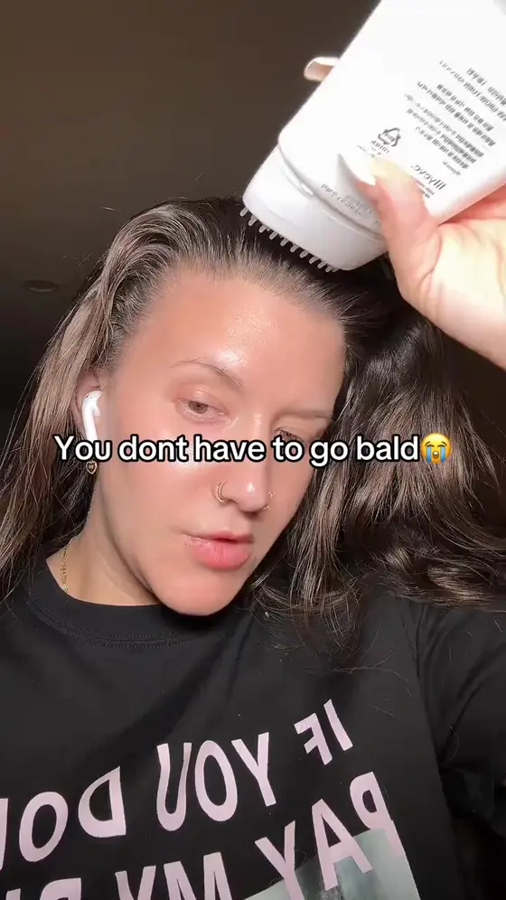 Stop Losing Hair In 4 Weeks 🧡