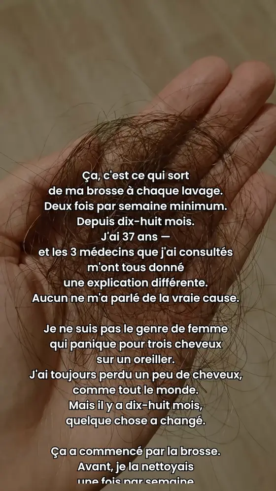 Le stress n'a pas causé votre chute de cheveux.