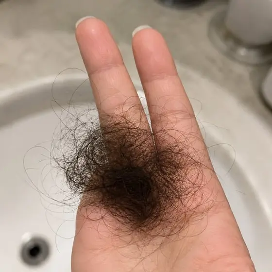 The No BS Solution For Hair Loss 👆