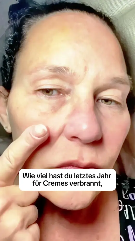 Genug Geld für Cremes verbrannt?