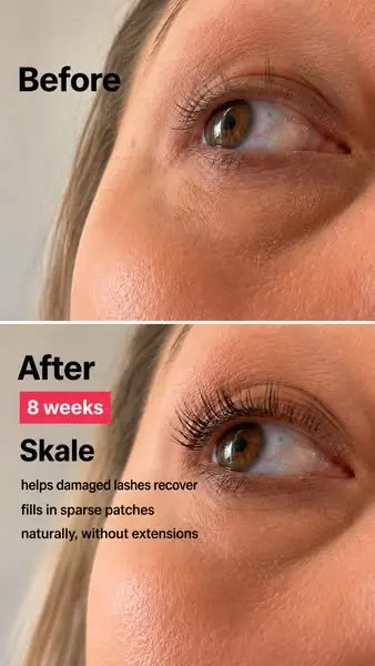 40% off Skale Lash Serum