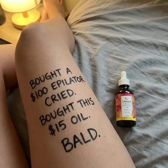 Say Goodbye To Razor Bumps