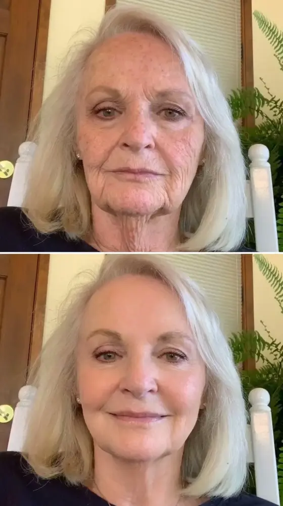Korean Face Lift in a Serum