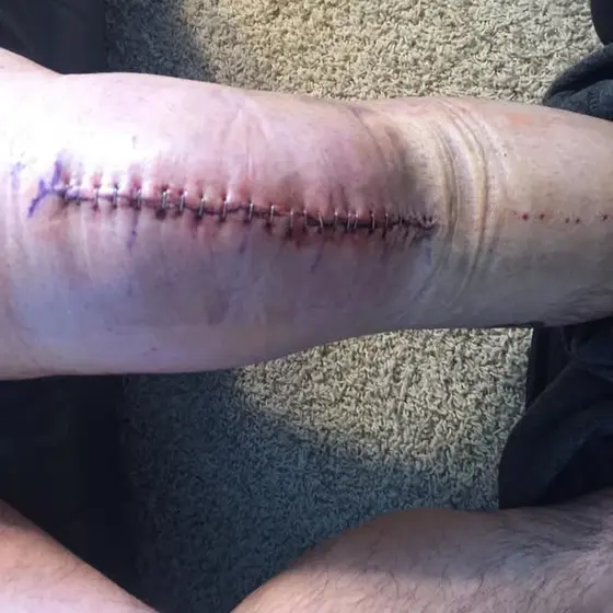 Read This If Knee Pain Is Stealing Your Life ☝️