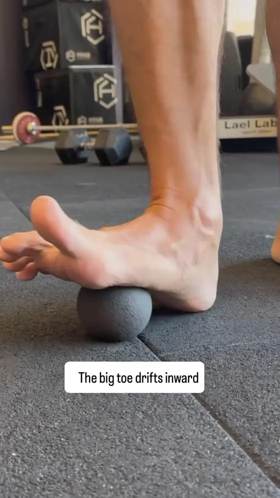 Comment: “bunion” to learn more.

One important thing to understand is that we…