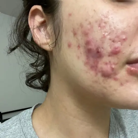 What dermatologists NEVER tell you!