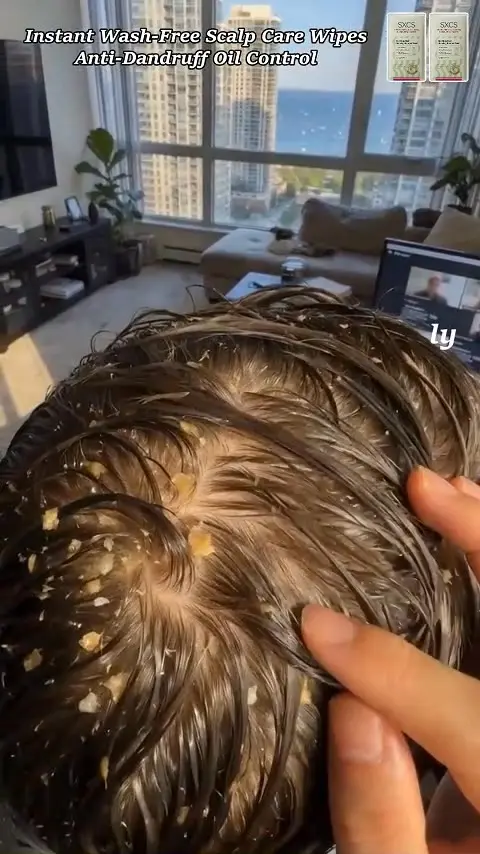 🔥 50% OFF · No-Rinse Hair Cleansing Shampoo Towel ✨