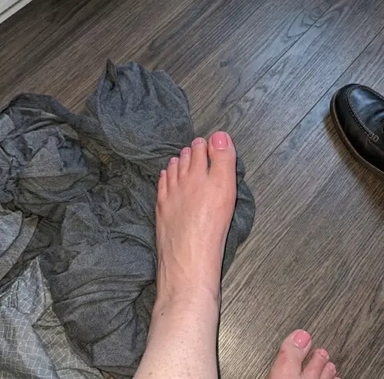 I Eliminated 8 Years Of Foot Pain In 5 Days 👇