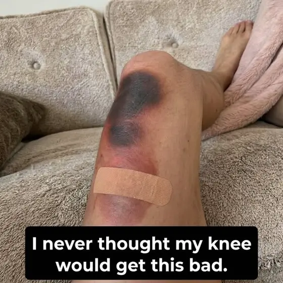Hesitant About Knee Replacement ☝️