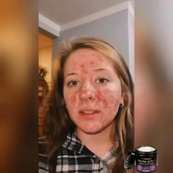 If you struggle with skin tags, dark spots, loose wrinkled skin or weird purple…