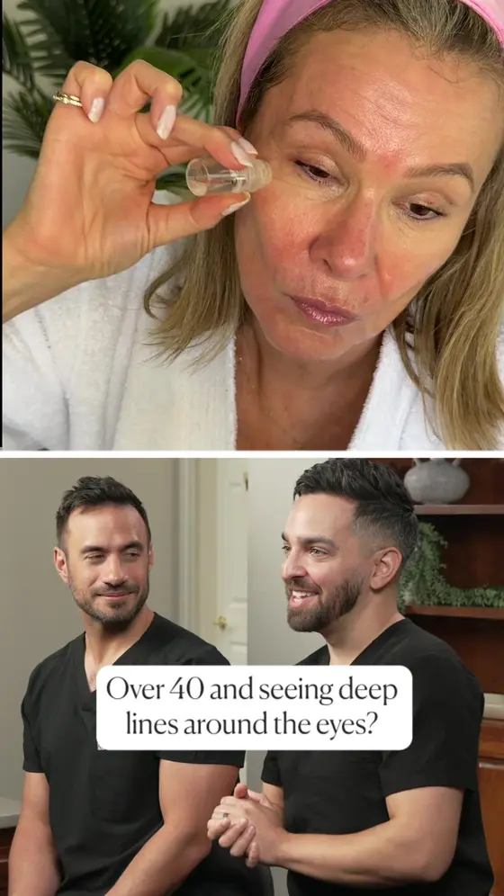 Crow’s feet? Here’s what helps ⬇️