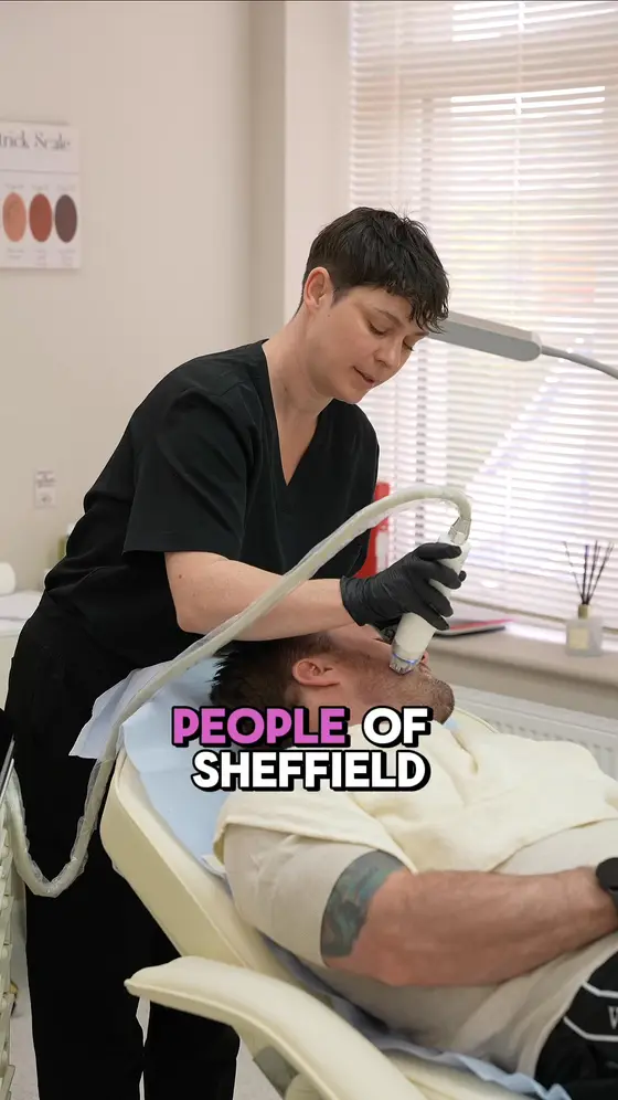 RF Microneedling Intro Offer £199