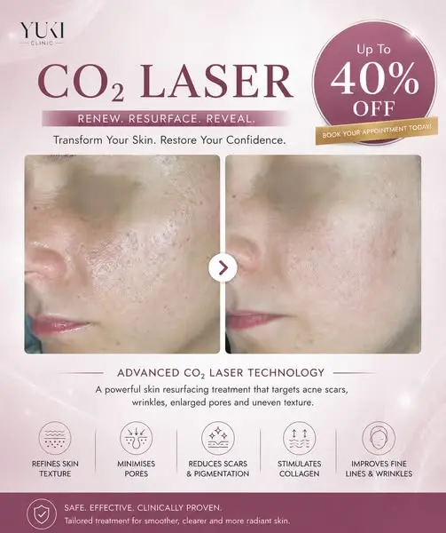 🌟Up To 40% Off CO2 Laser – The Gold Standard in Skin Renewal Has Arrived💖