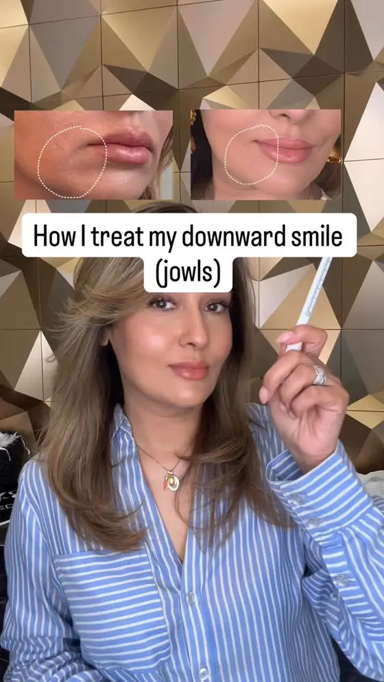 🧐 So my research to treat the downward smile (jowls) had gone on for months an…