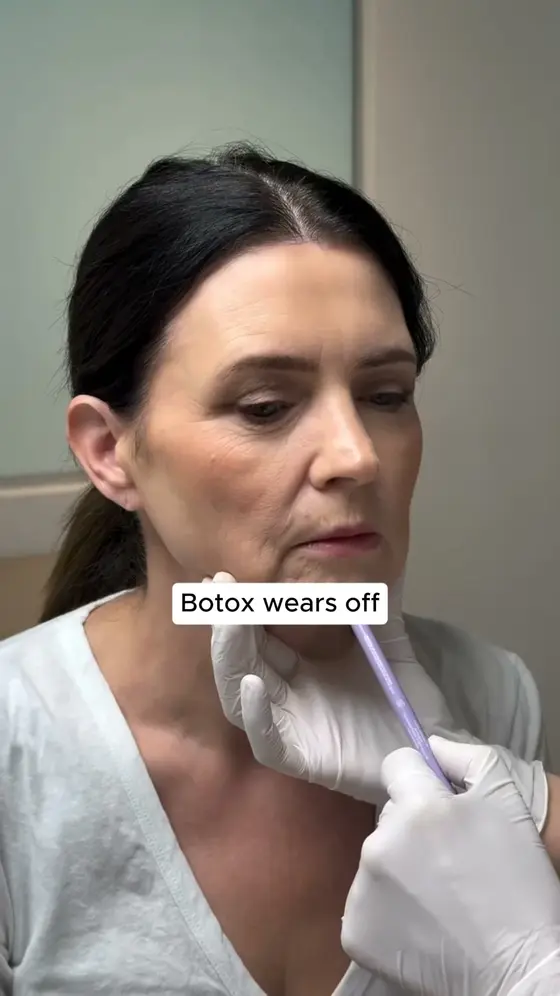 Rejuvenate Your Skin