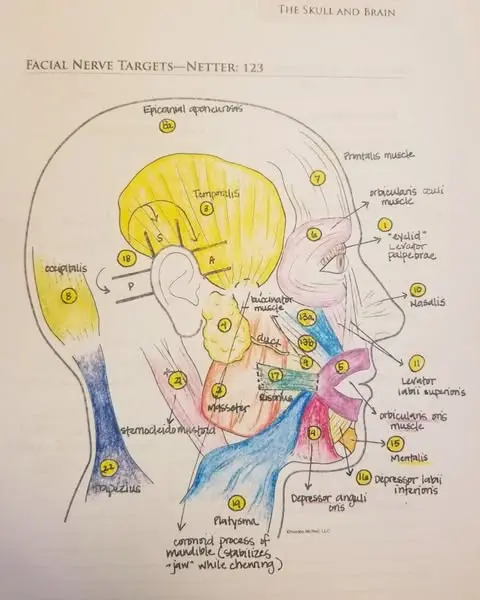 What My Nursing School Flash Card Said About My Mom's Migraines