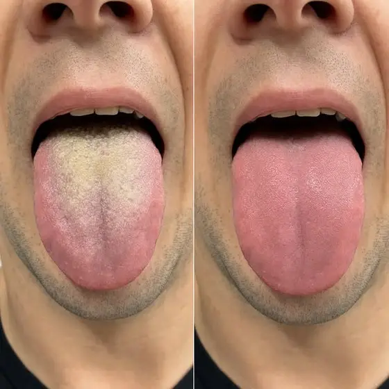 Your tongue tells all