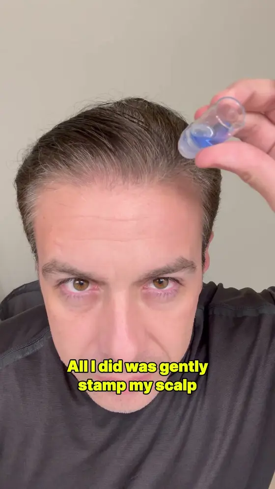 Restore Your Hair