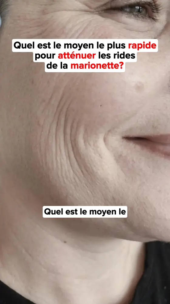 Experte soin de la peau: "Arrêtez de gaspillez votre argent sur des crèmes inut…