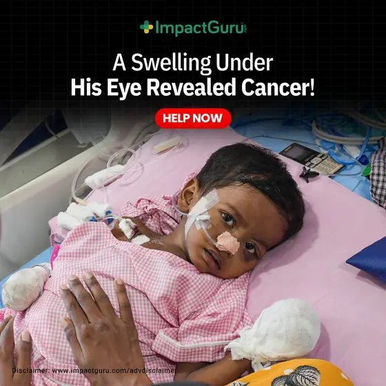 A Swollen Eye Turned Out To Be Stage 4 Cancer In A 2 Y/O