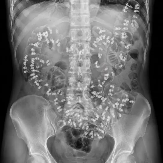 Support Healthly Digestion Naturally