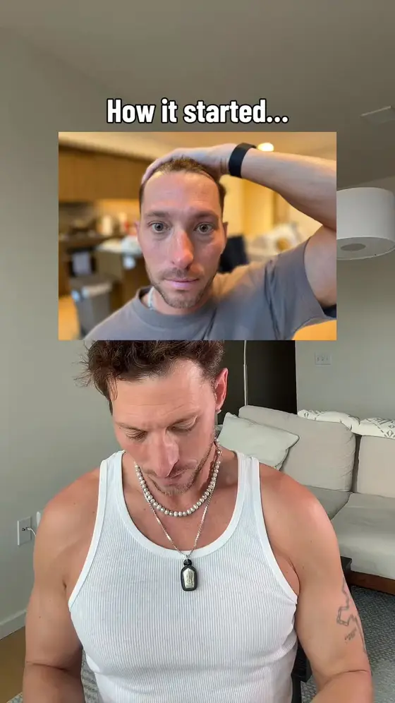 Thicker Hair Starts at the Scalp