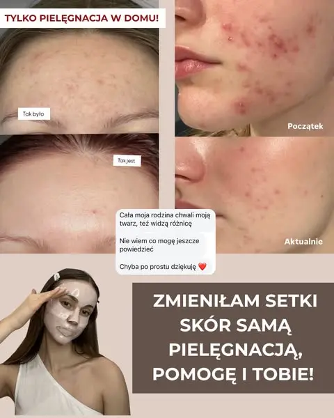 Pielęgnacja to najlepsza inwestycja na przyszłość!