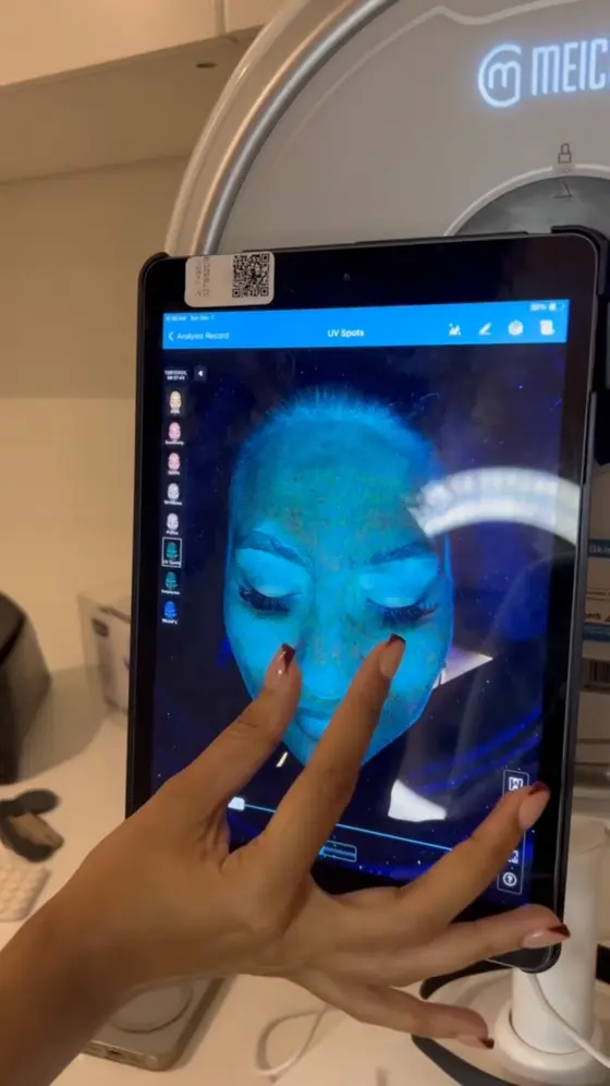 £30 Skin Scan  – Find Out What Your Skin Needs!