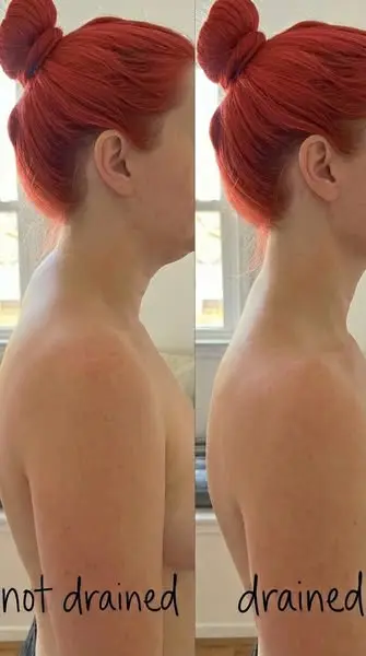 Vagus Nerve Reset Changed Life