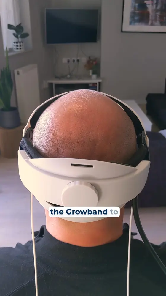 Male Hair Loss is a Cascade of breakdowns.