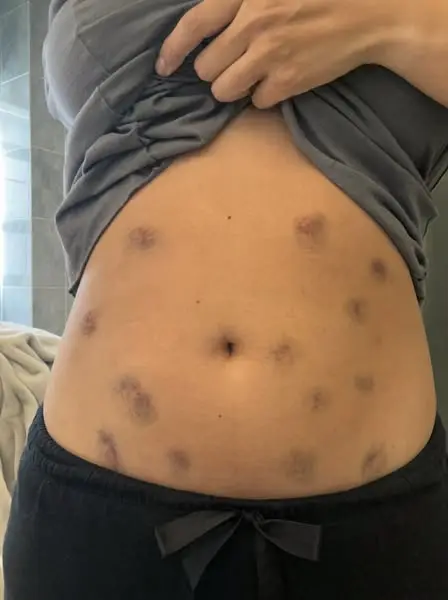 A Fertility Nurse Checked Her Own Lining