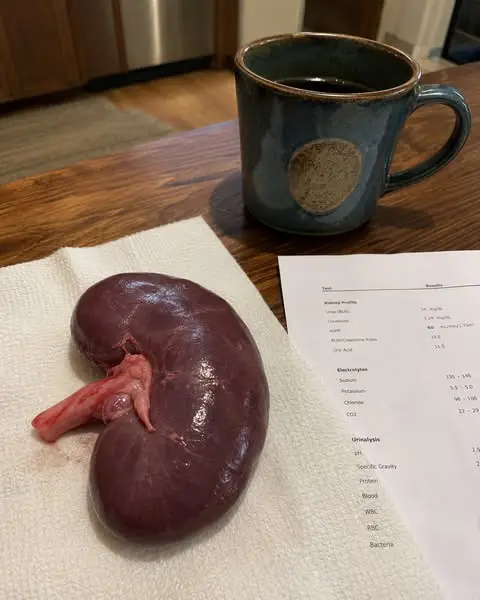 "Stable" Is the Most Dangerous Word Your Kidney Doctor Can Say
