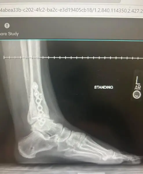Read if your joints are ruining your life