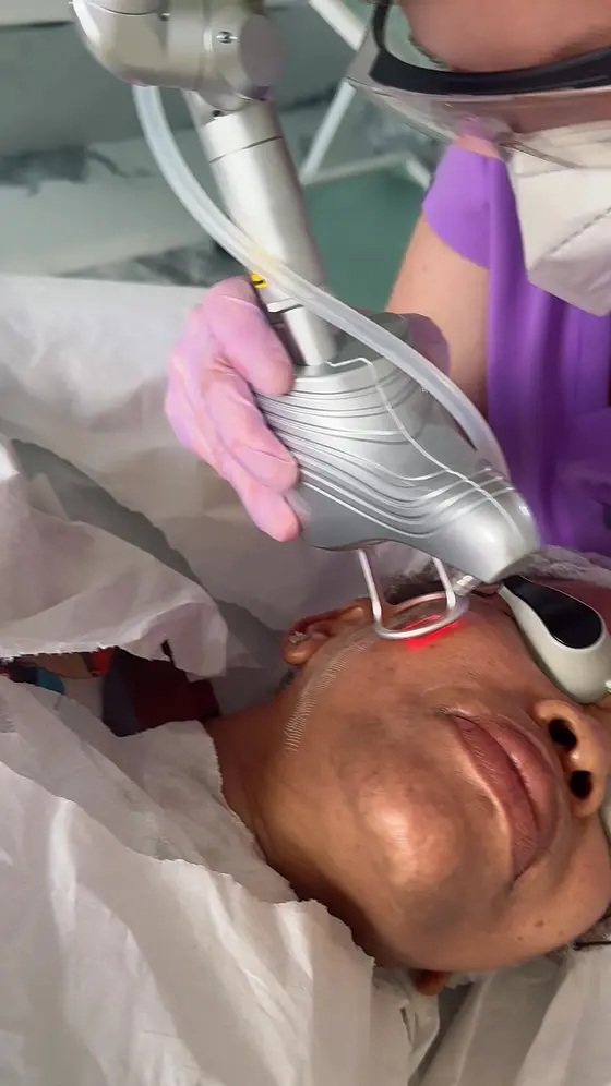 Anti Ageing Skin Laser Treatment - from £449